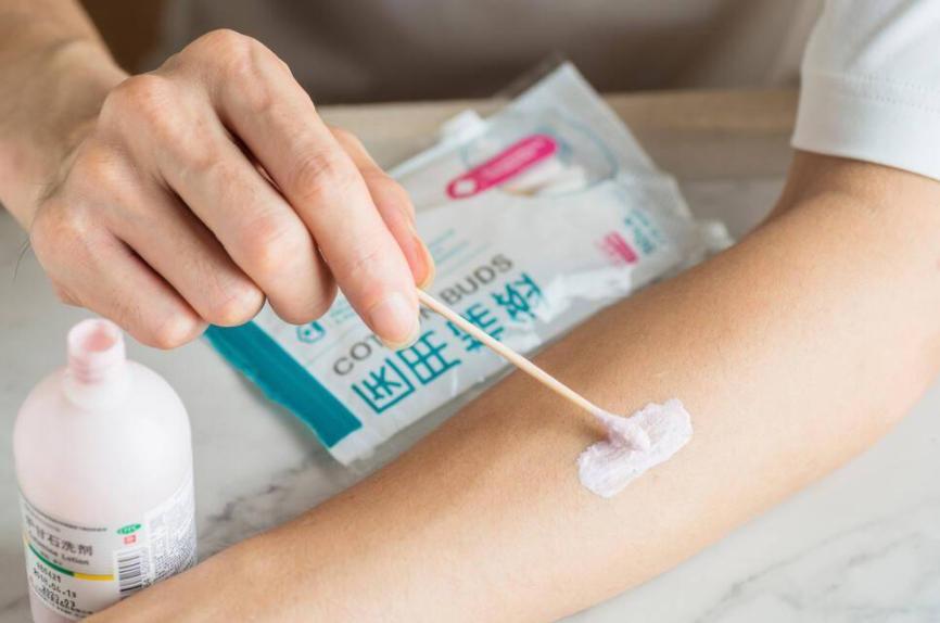 世卫组织推荐炉甘石,炉甘石洗剂哪个牌子的效果比较好