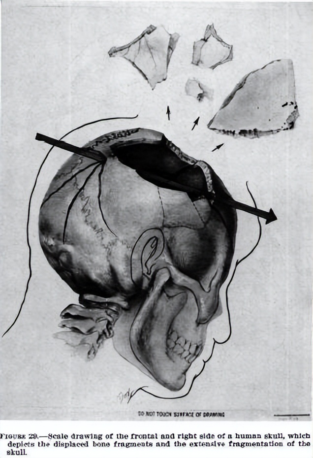 肯尼迪为何会被杀,肯尼迪之死真正原因