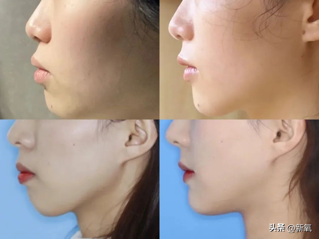 你觉得牙齿对人的颜值影响大吗,牙齿会不会影响你的颜值