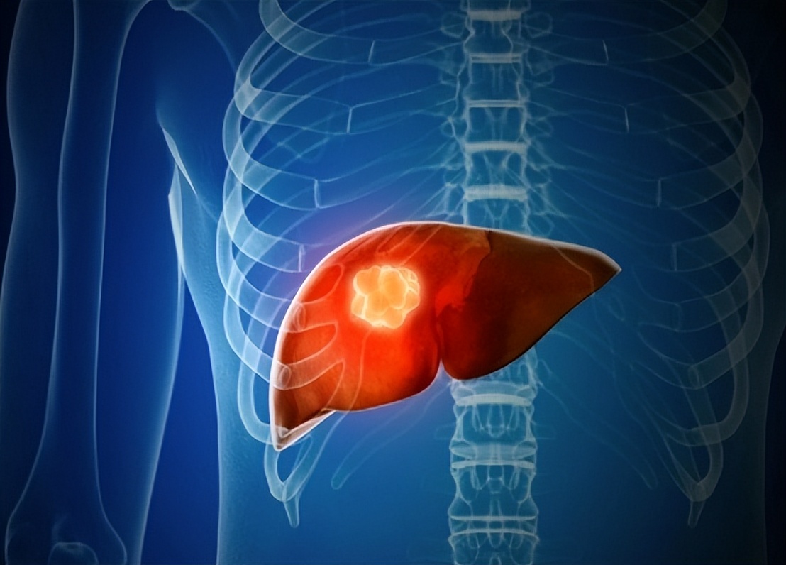 打一针治疗癌症120万元能治肝癌吗,治肝癌一针四十万