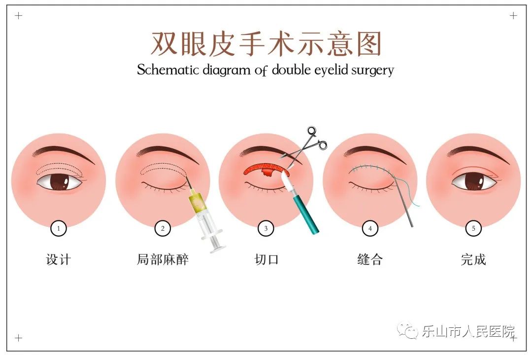 冬天适合做哪些医美项目,秋冬季适合做的医美项目