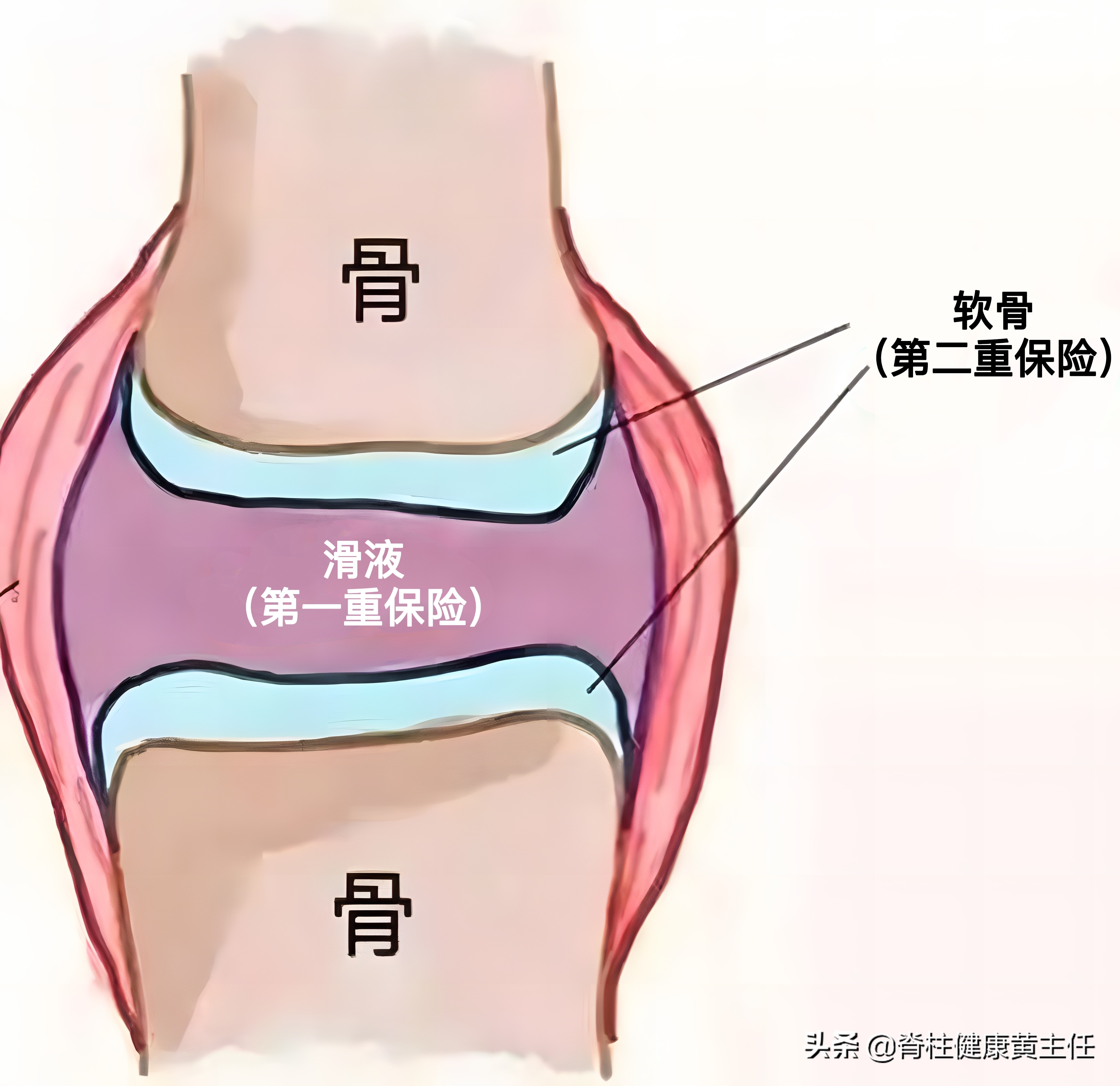 膝关节有积液是怎么回事?积液要抽出来吗?告知您