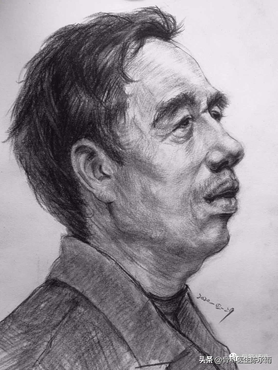 胫骨开放性骨折处理方法,胫骨腓骨开放性骨折能评几级伤残