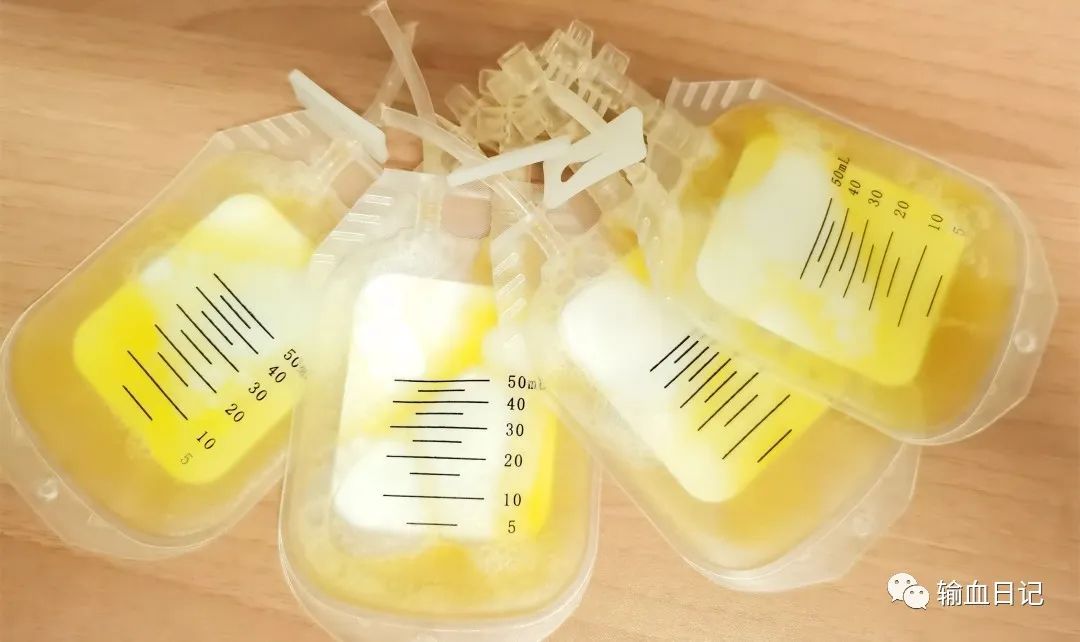 富血小板血浆治疗骨质增生吗,富血小板治疗脂溢性脱发