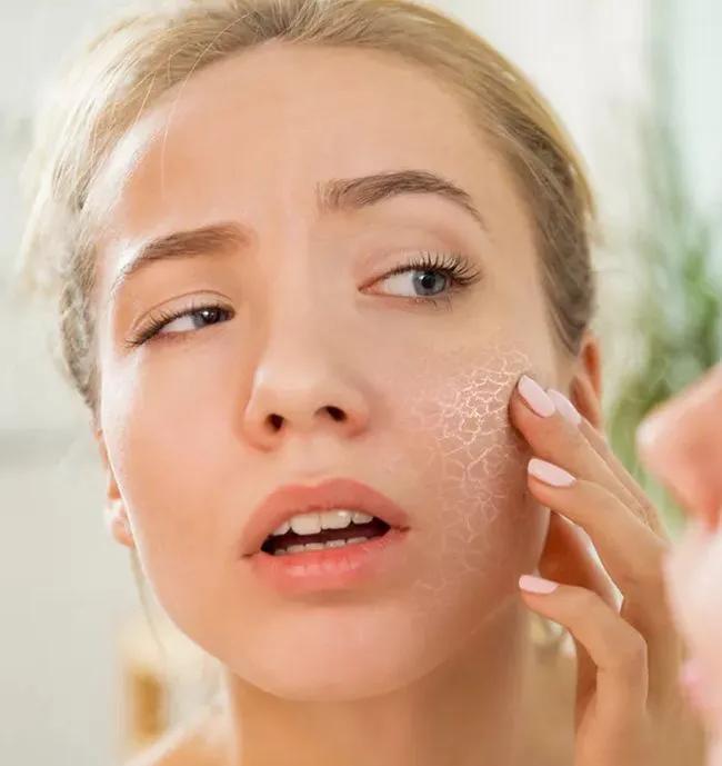 皮肤干燥松弛与内分泌失调,皮肤出油是干燥的原因吗