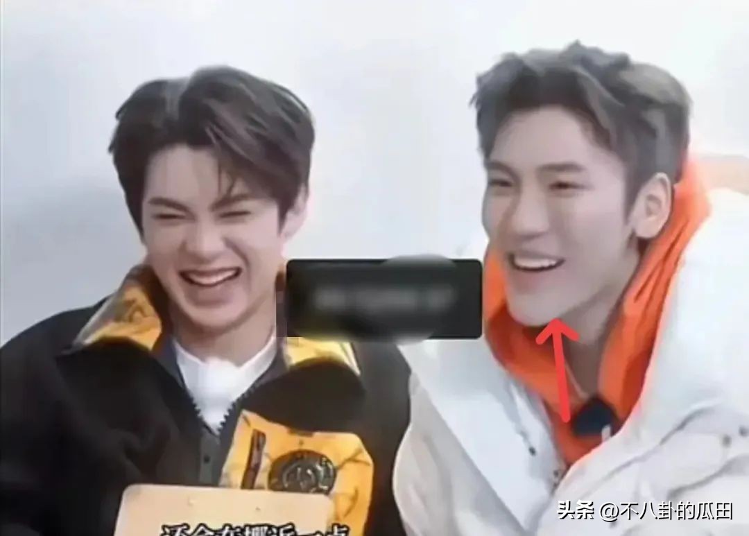 蔡徐坤下巴太尖惹争议图片,蔡徐坤下巴是假体吗