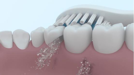 儿童电动牙刷的好处和危害,电动牙刷的危害弊端
