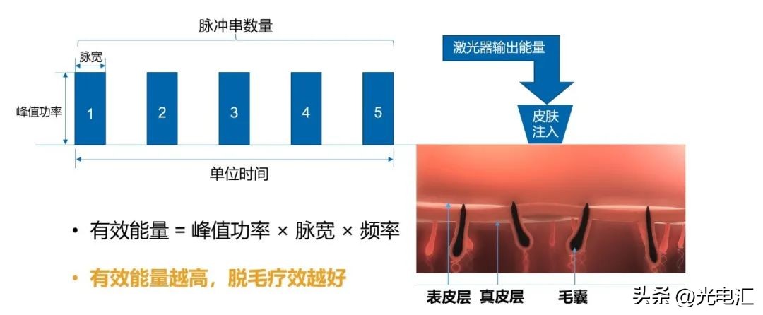 半导体激光脱毛产品技术要求,半导体激光脱毛仪能产生什么效益