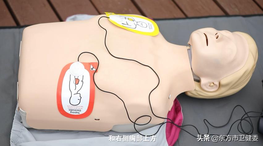 使用aed的正确方法,收藏知识和技巧