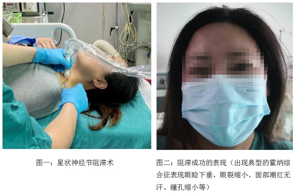 怎样治愈头痛失眠,快速缓解失眠头疼