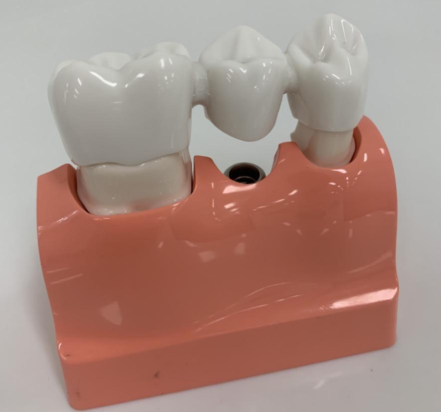 牙齿修复健康宣教知识,牙齿修复的十大常见问题