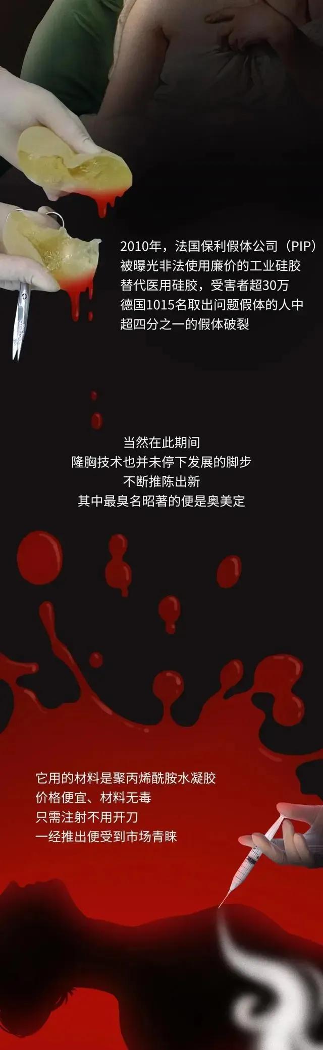 第一个隆胸的女人,全球最红隆胸女人