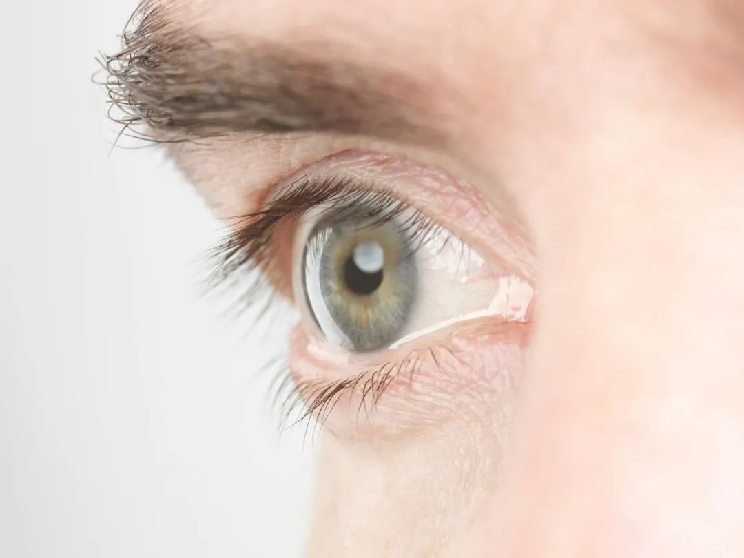 舒缓眼压,舒缓眼压热敷眼贴