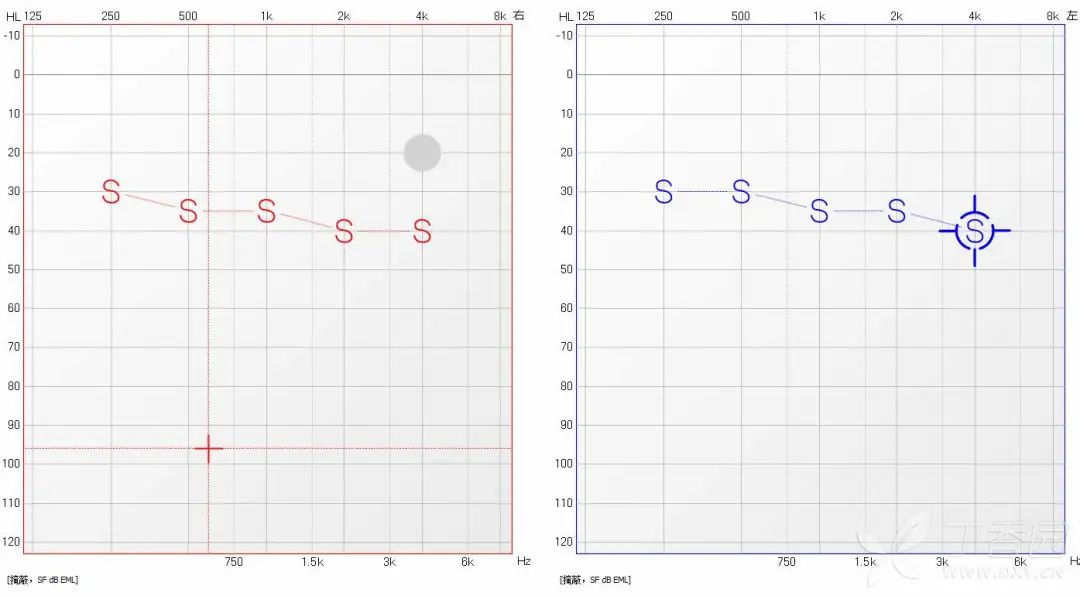 双耳听力相差需要助听器,双耳听力70分贝戴助听器有效吗