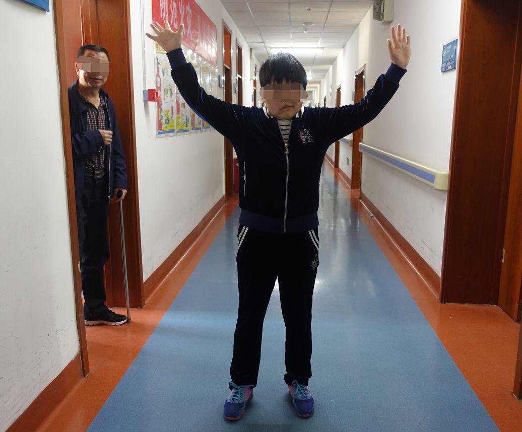 听神经瘤出现脑积水和出血,听神经瘤手术后颅压高症状