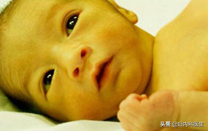 新生儿黄疸蓝光照射有什么危害,新生儿黄疸高20做蓝光有危害吗