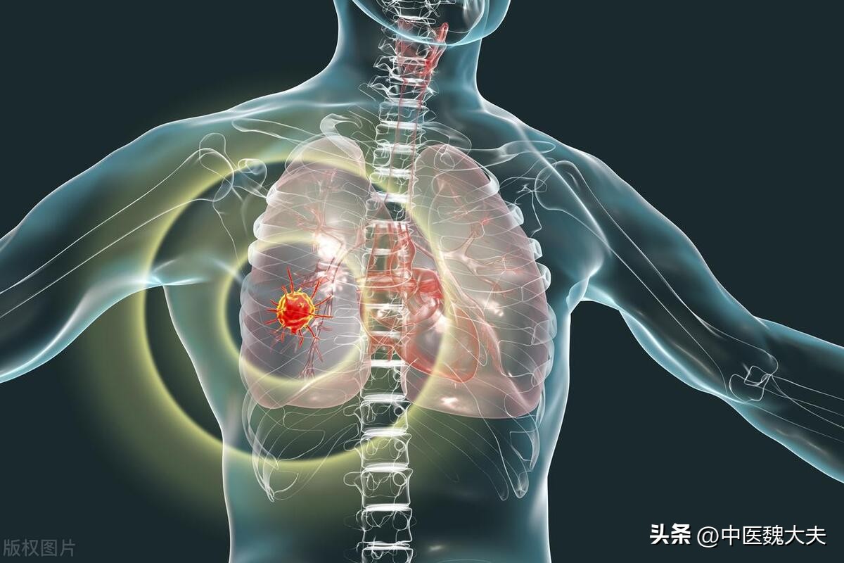 肺部疾病的痰液颜色,观察痰液颜色了解肺部疾病