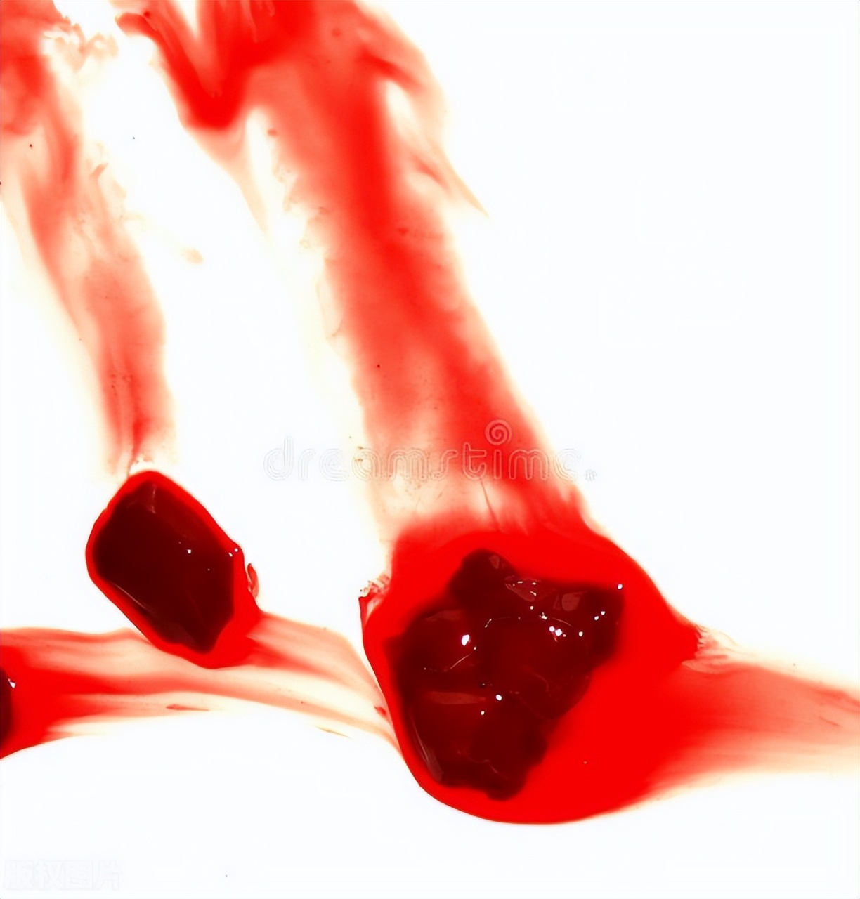 生理期血块很大块是什么原因,为什么生理期会流出血