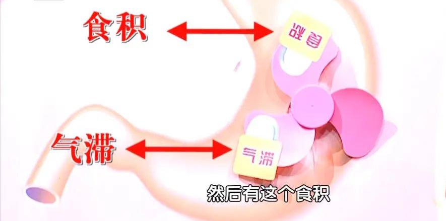 早上吃撑了一天都很撑怎么办,一天到晚吃饱了撑着是什么原因