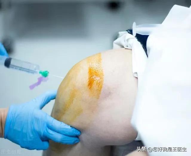 激素对疼痛有缓解作用吗,激素是止痛的吗