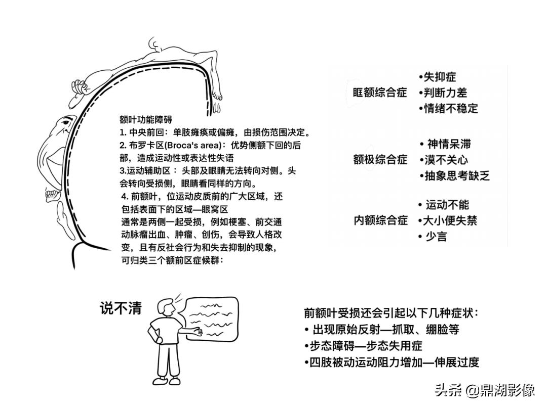 大脑皮层的解剖与定位,大脑解剖学习绘图笔记