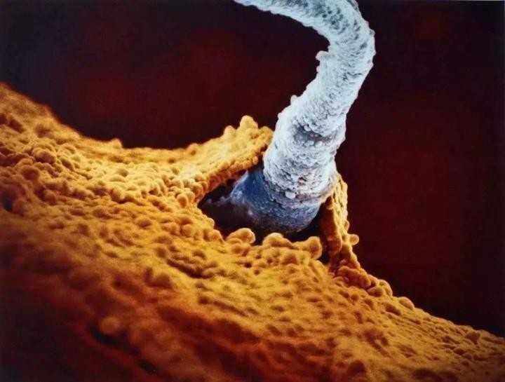 只有一个精子怎么会有双胞胎,只有一个精子正常能受孕吗