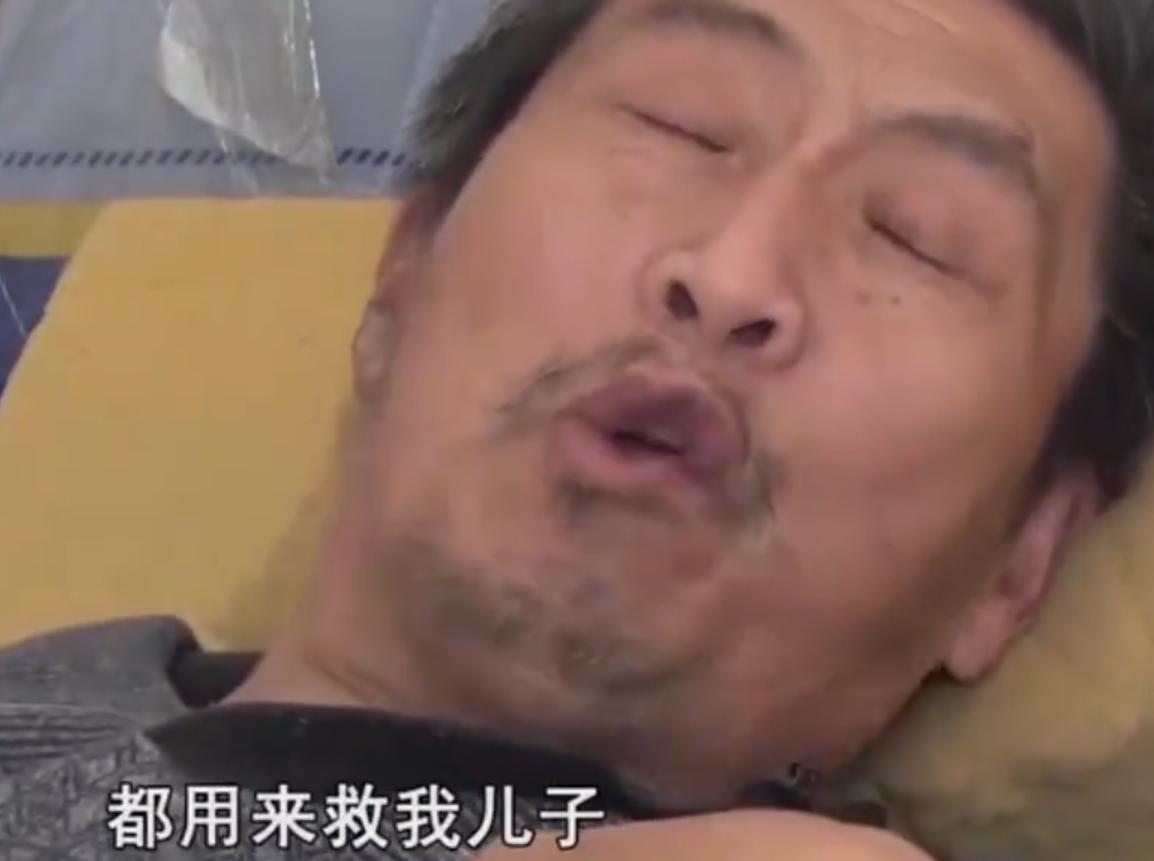 河南男子掉锅烫伤爸妈植皮救儿子,河南男子掉入油锅后续