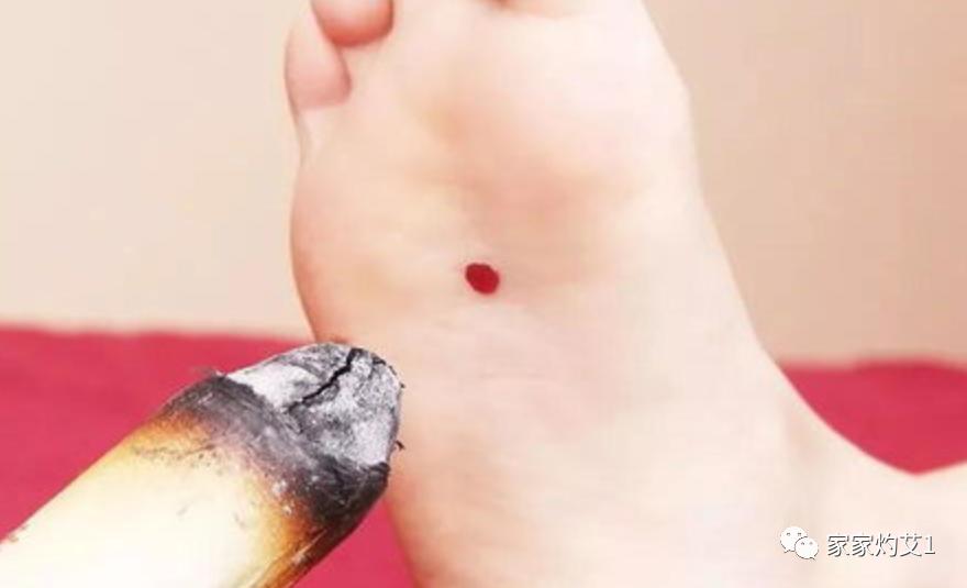 艾灸治疗高血压的方法,高血压阳气瘀阻