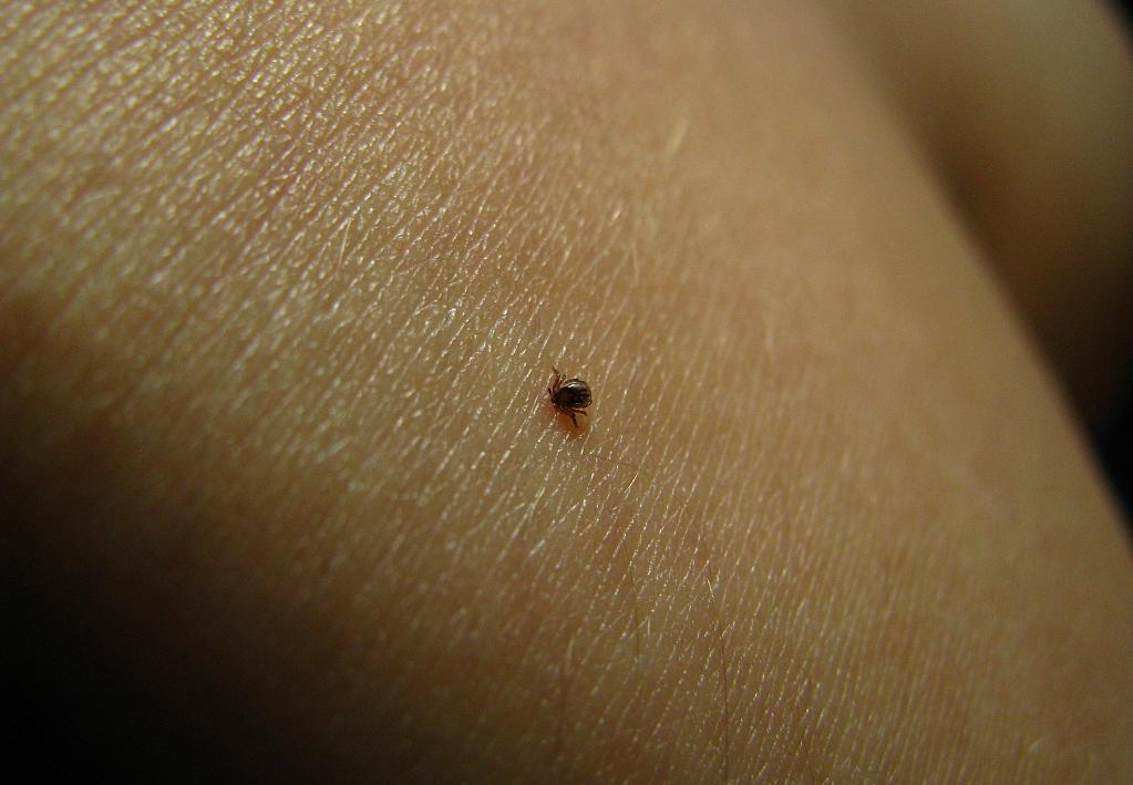 蜱虫致4位老人死亡,河南又一老人因蜱虫病死亡