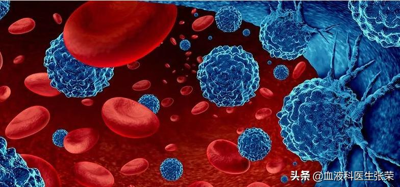 慢性血液病血小板减少的危害,难治性免疫性血小板减少问题解答