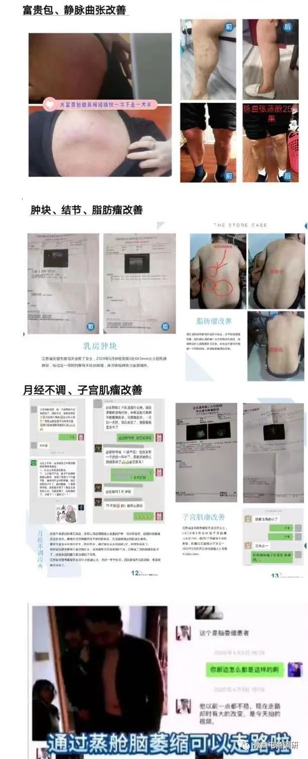 躺能量舱真的可以调理身体,躺能量舱有什么功效