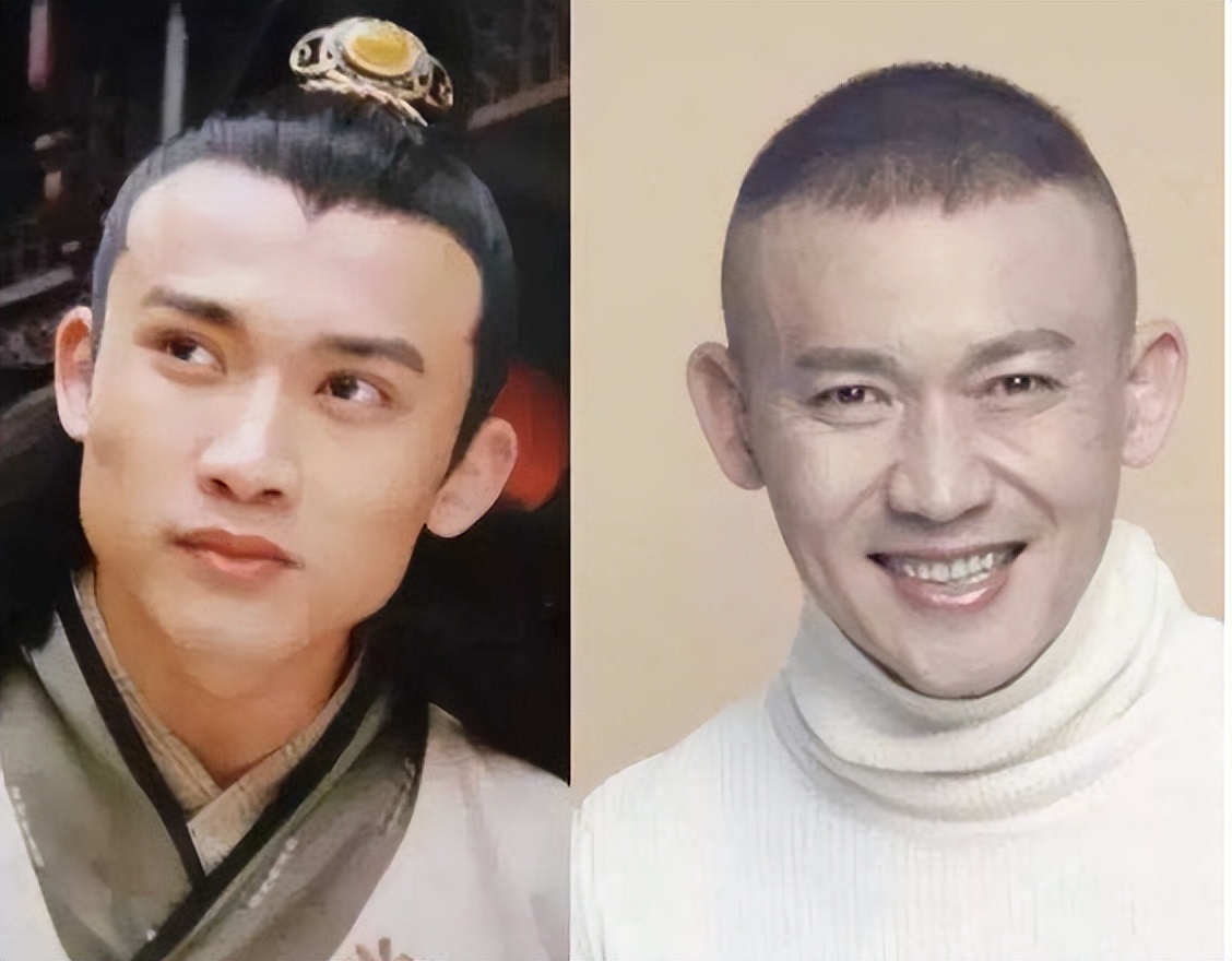 电视剧的整容脸,影视剧中整容脸