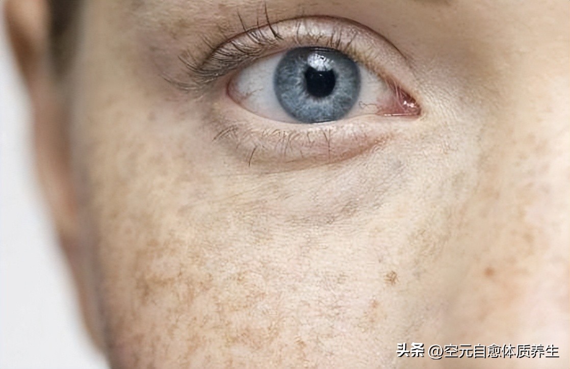 面色发黄是不是要补气血,脸发黄补气血最有效的办法