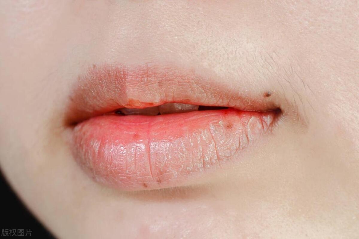 肾阴虚口干舌燥吃什么药,肾阴亏虚症喉干咽干