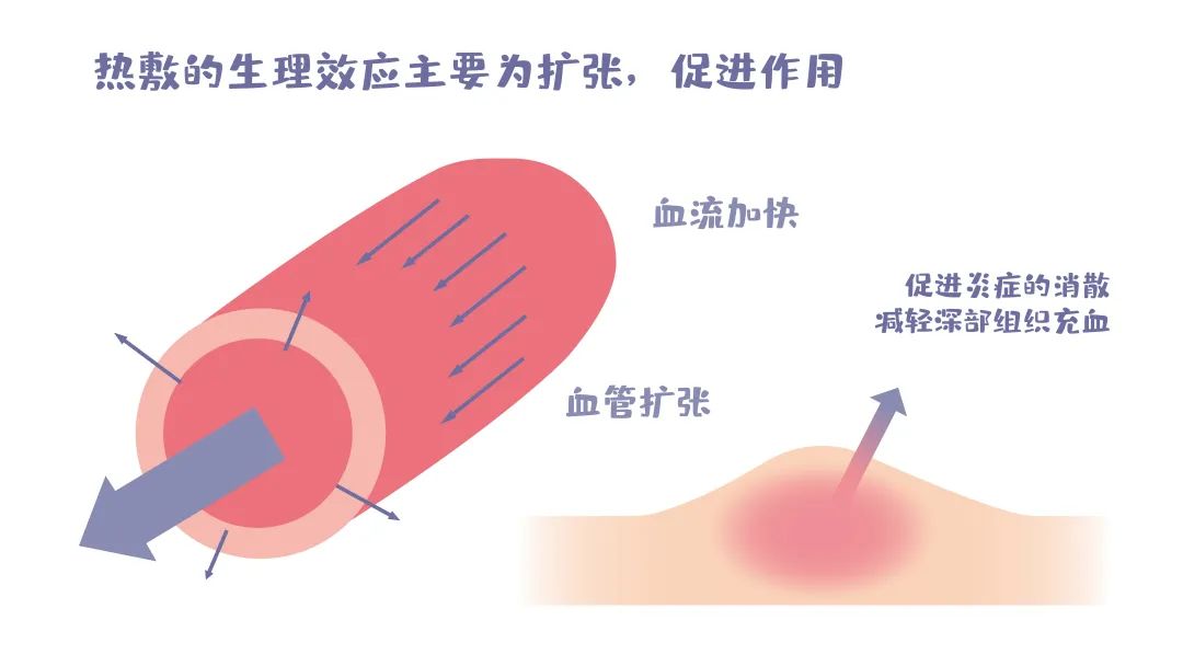 儿童近视了眼部热敷还是冷敷,缓解眼部疲劳热敷好还是冷敷好