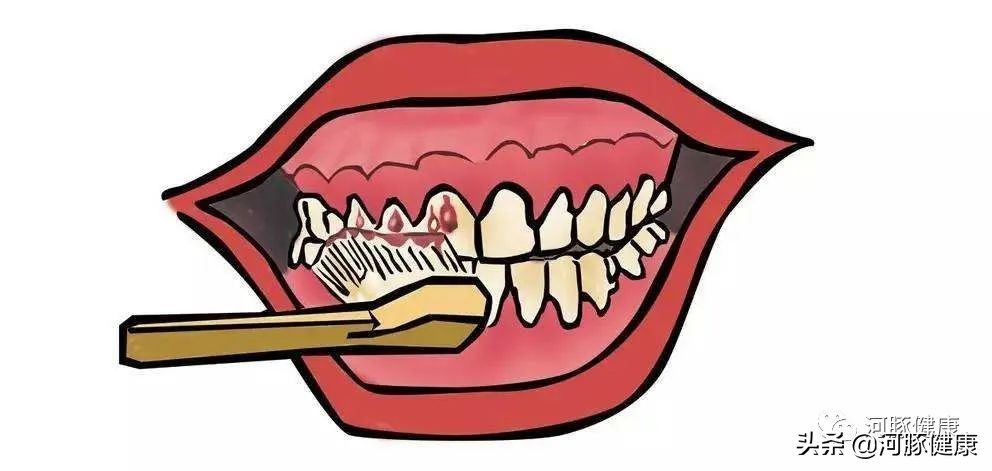 刷牙时牙龈出血要警惕,刷牙时牙龈出血牙膏会进入血液吗