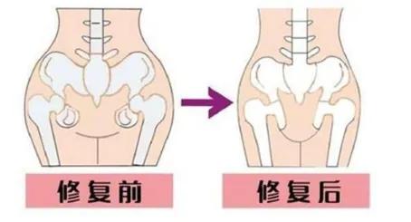 中年女性在家初学练瑜伽,中年妇女练太极好还是练瑜伽好