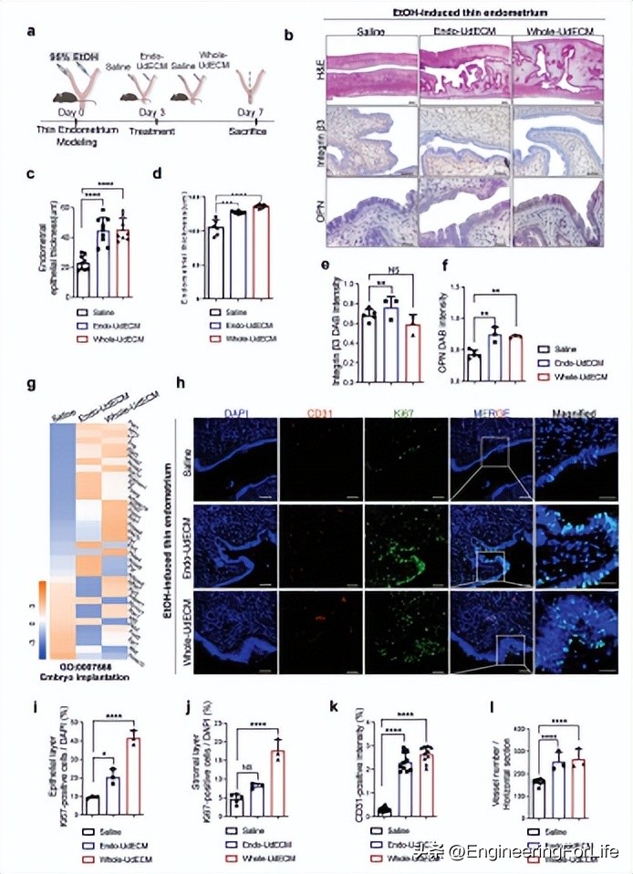 子宫来源的脱细胞ECM介导增强子宫内膜再生和生育能力