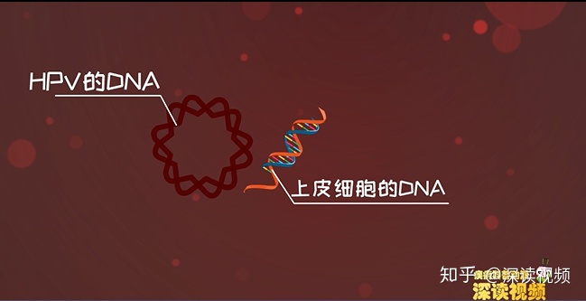 宫颈癌——有望成为被消灭的第一个癌症