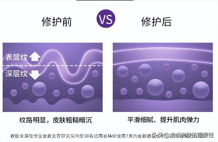 淡化细纹抗皱排行榜前十名,淡化眼角纹最好的产品名牌