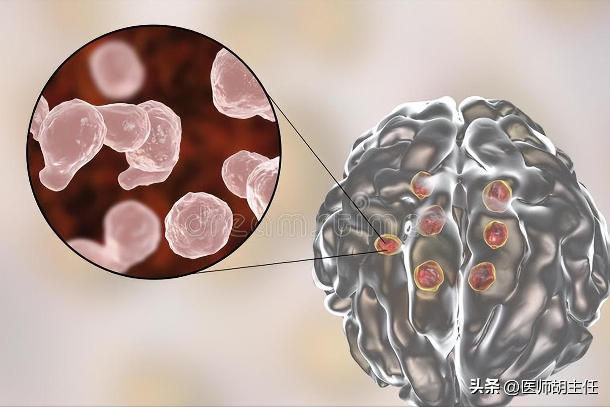 体检肝部囊肿最大2.8怎么办,体检发现肝囊肿肾囊肿