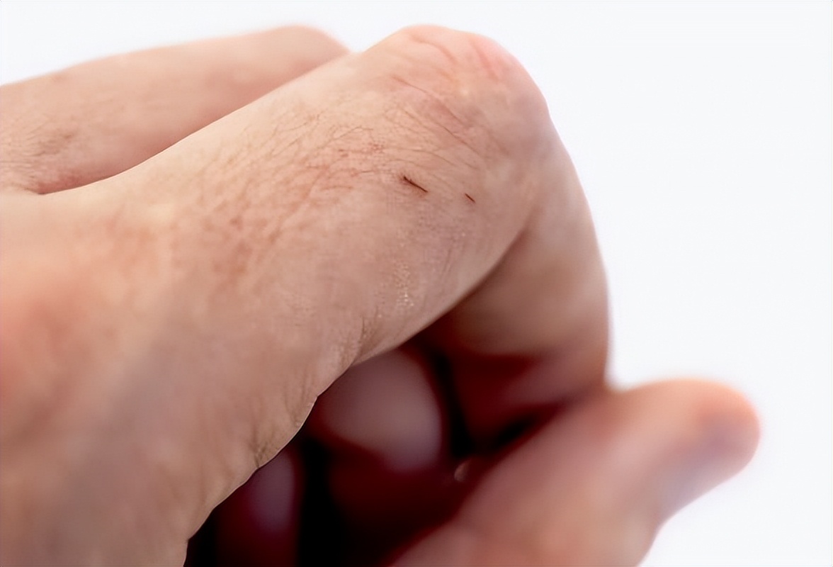 香蕉皮的用法大全,香蕉皮的用法怎么用