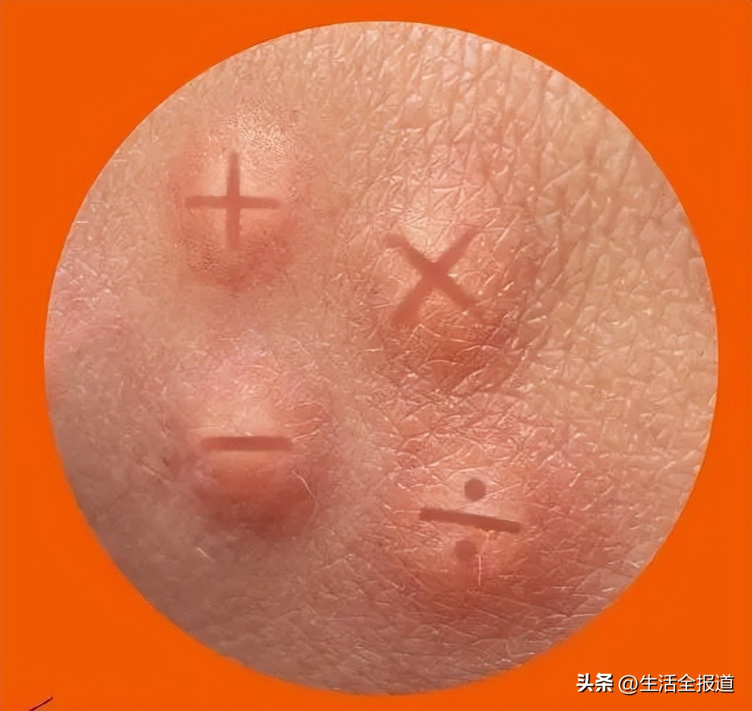 有什么老方法可以快速止痒蚊子包,怎么给蚊子包止痒