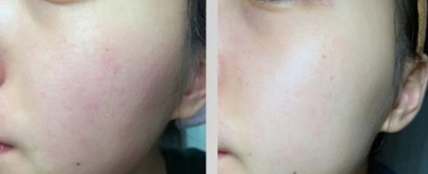 孕期护肤品推荐排行0-24岁,孕期平价护肤品排行榜