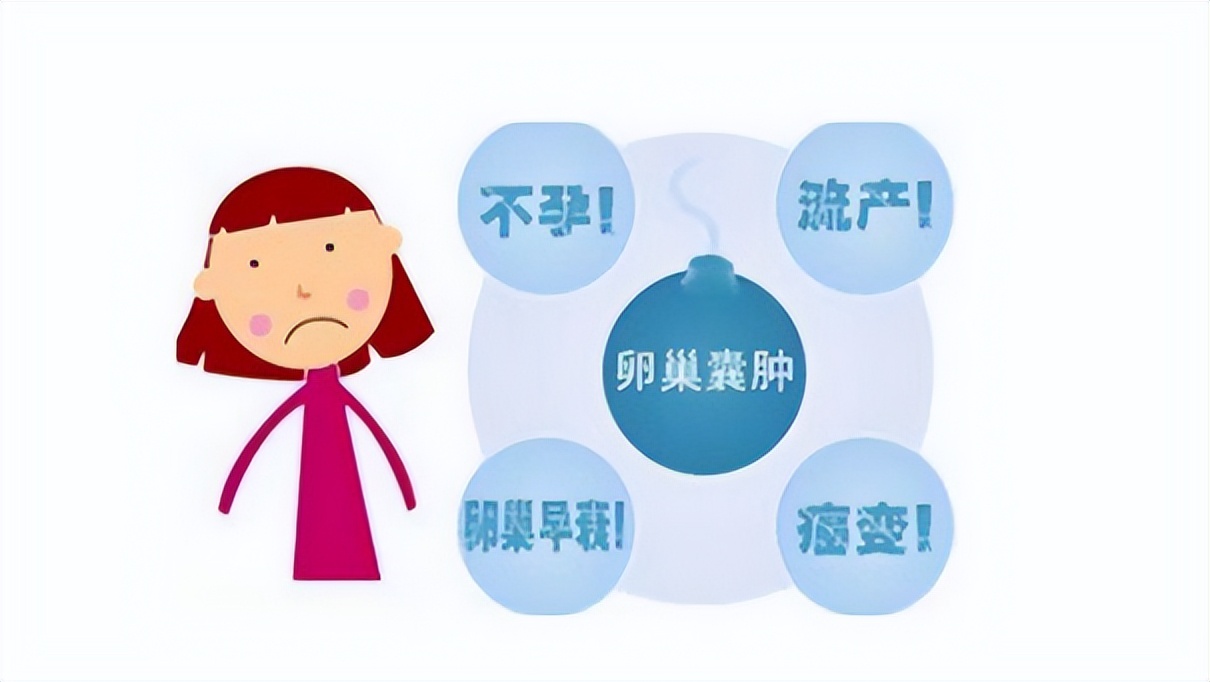 卵巢囊肿多是“拖”出来的！医生提醒：身体有这5种情况，要警惕