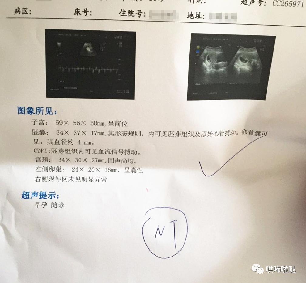 怀胎十月终于要卸货,回忆一下刚出生的宝宝