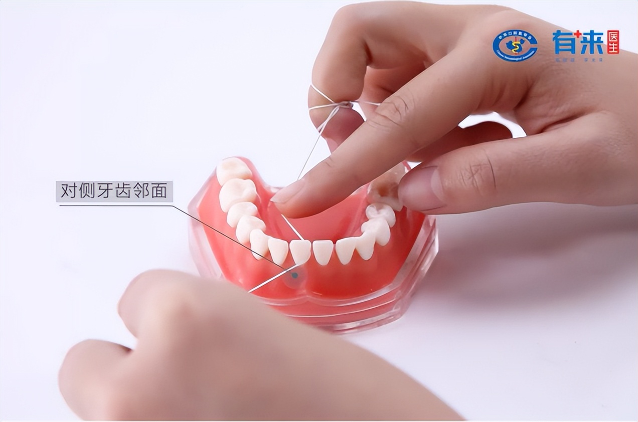 我们的目标是没有蛀牙出处,有没有保护牙齿不蛀牙的办法