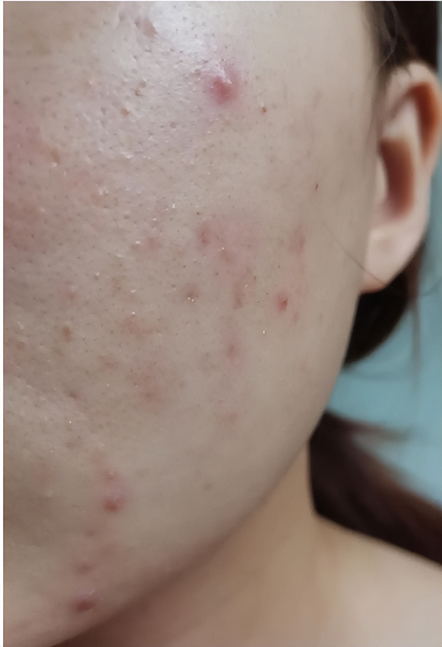 枕头发黄怎么去除最快方法,乳胶枕头时间长了发黄掉渣怎么办