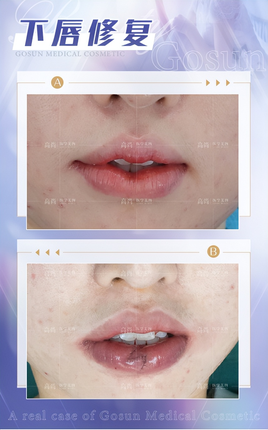 公认最好看的四种嘴唇,什么样的嘴唇最好看呢