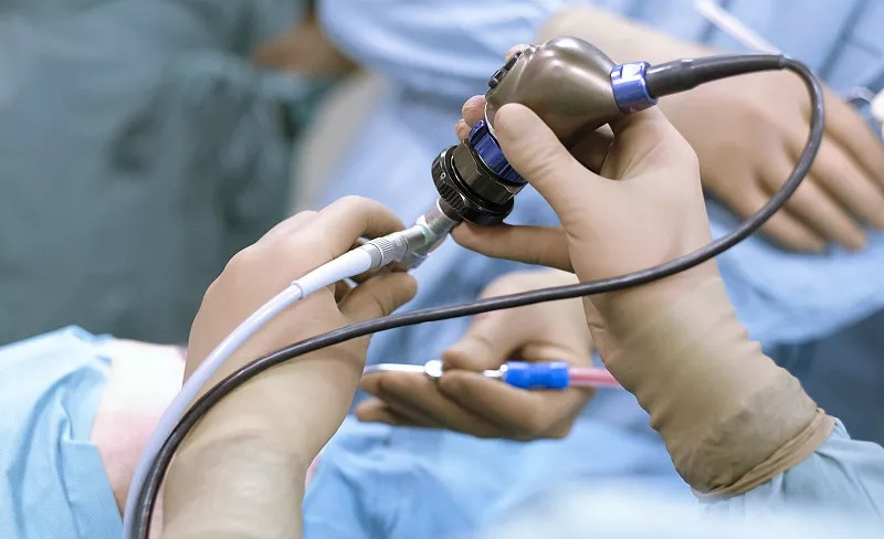 70岁老人胆囊息肉能微创手术吗,78岁胆囊息肉要动手术吗